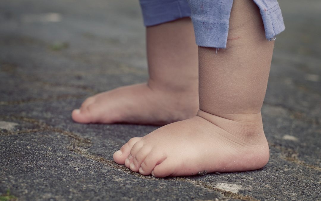 Is my Child Normal? They have Flat Feet!